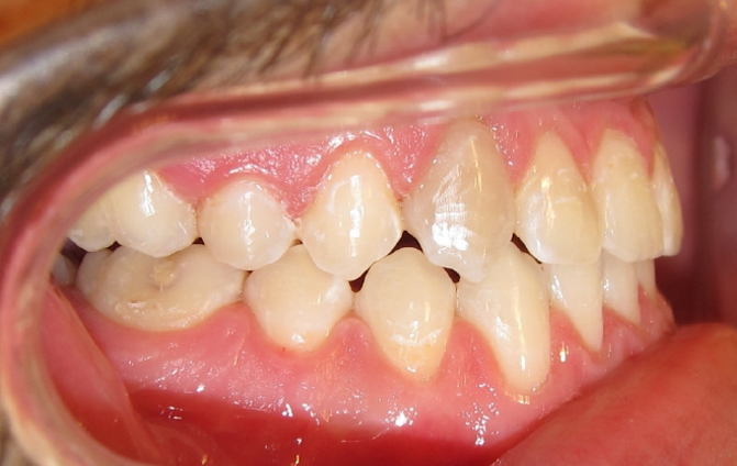 After image