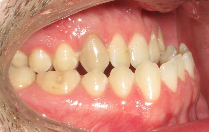 Before image