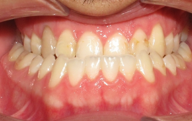 Before image