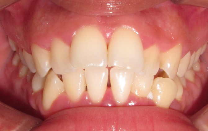 Before image