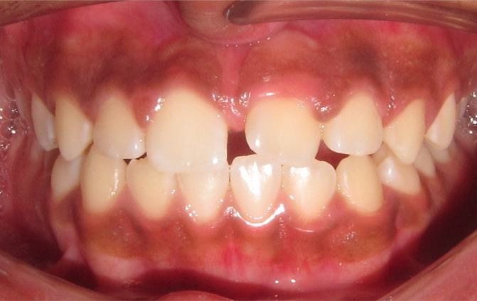 Before image