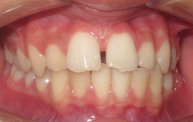 Before image