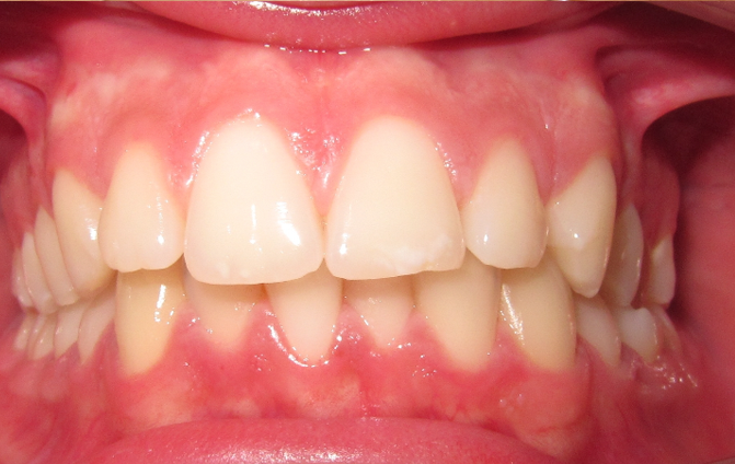 Before image
