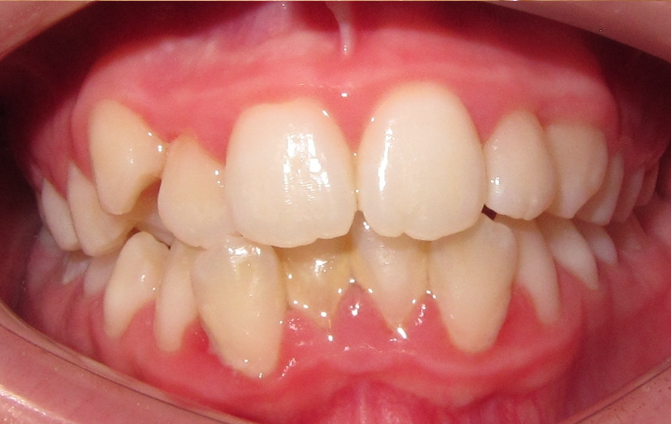 Before image