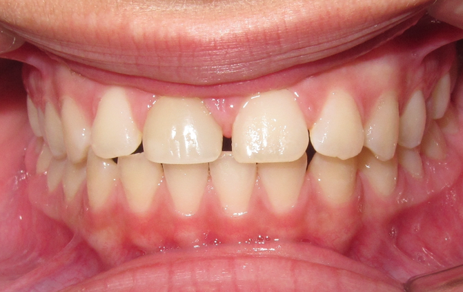 Before image