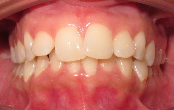 Before image