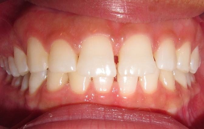 Before image