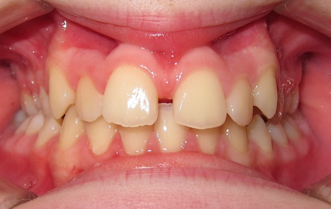 Before image