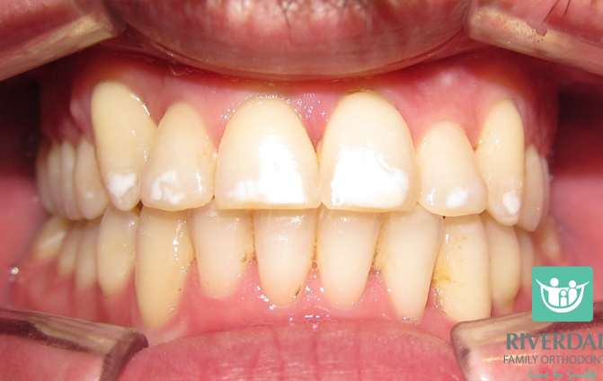 After image