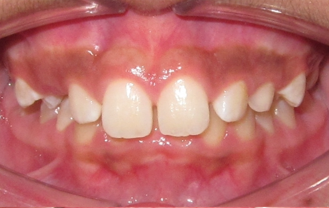 Before image