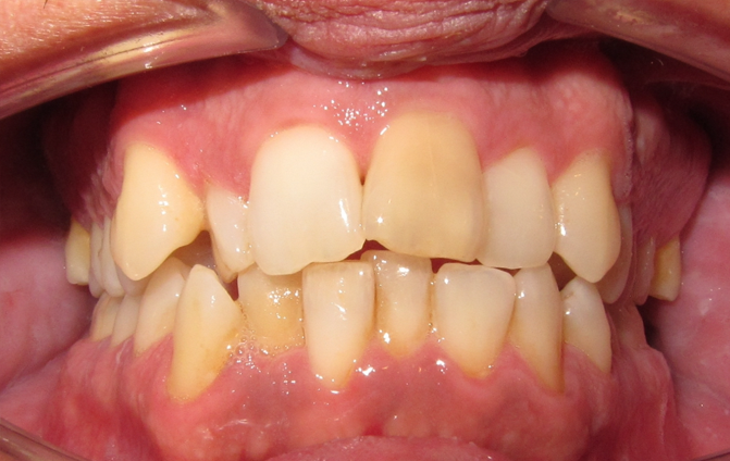 Before image