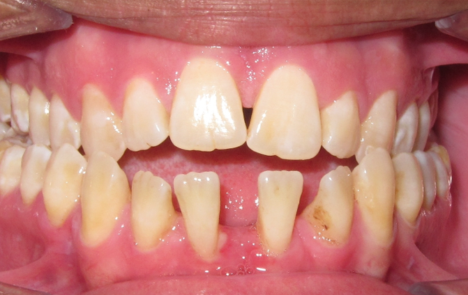 Before image