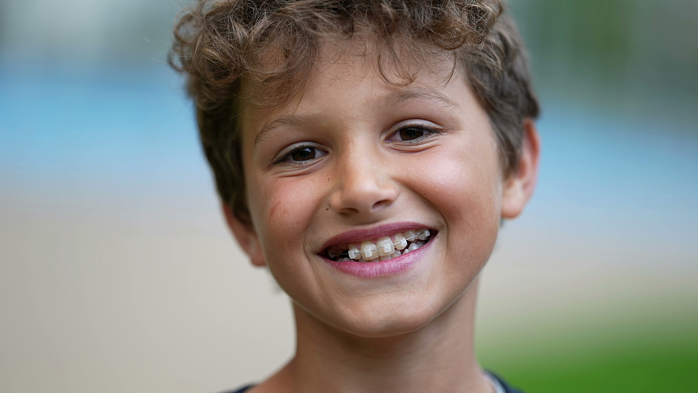 Signs Your Child Need Braces
